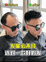 -唐风采假发补发定制