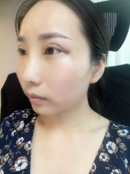 -洁铭新加坡医美