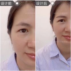 -MLP美丽派·问题肌疗愈中心
