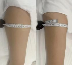 -Lily纤美·科技减脂中心