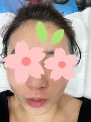 体验后-坤如玛丽·医疗美容中心
