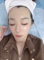 体验后-东剑医学美容·注射美学中心