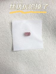 -清疣美疣·痣·斑净肤中心