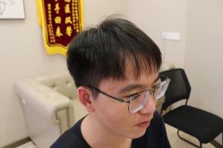 -大麦微针植发丨全国连锁