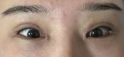 体验后-成都艾特他整形外科医院