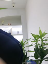 -苗医生0感科技祛痘