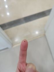 -伊丽莎白医疗美容