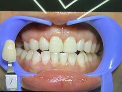 -极光口腔·矫正种植修复(锦江院区)