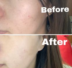 -MZ SKIN CARE逆齢驻颜中心