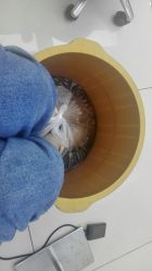 -派恩宜灰指甲鸡眼嵌甲手足癣