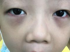 -爱齿尔口腔美学种植中心(永清院)