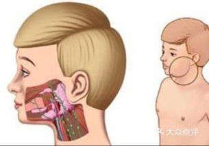 吃饭老咬到腮帮子咋回事？