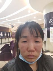 -安徽合肥韩美整形外科医院