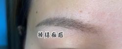 -OnFaer.纹眉半永久无创洗眉