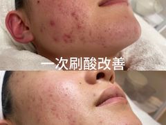 -上置·美兰优湖