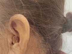 -安湃声助听器(密云店)