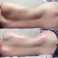 -清媚减肥瘦身纤体