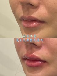 -北京米扬丽格医疗美容·联合丽格鼻整形中心