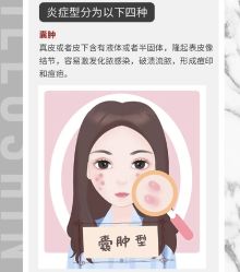 -苗方清颜痘肌研究所