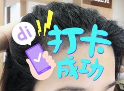 -大麦微针植发全国连锁