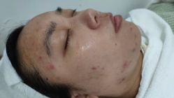 -悟空祛痘·亚健康皮肤管理中心