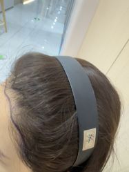-碧莲盛不剃发植发
