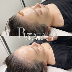 -RC半永久纹眉纹发际线
