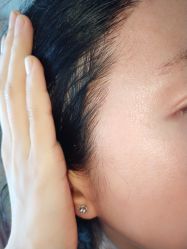 体验前-杭州米兰柏羽医疗美容医院