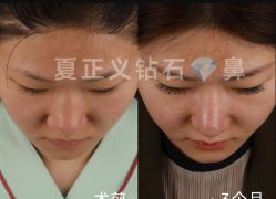 -北京米扬丽格医疗美容·联合丽格鼻整形中心