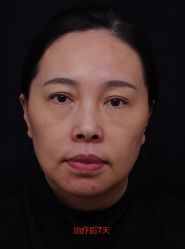 -苏州维多利亚美容医院