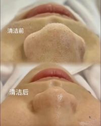 -SOS修丽可.痘肌修复中心