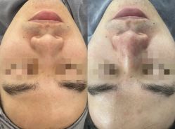 -SKIN79皮肤管理中心
