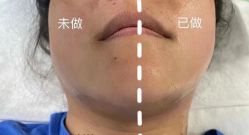-LUNA皮相美·骨相美高级美感
