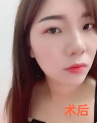 -天津健丽·去眼袋医疗美容机构
