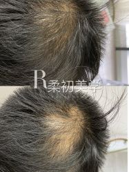 -RC半永久纹眉纹发际线