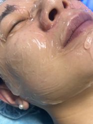 -长沙雅美医疗美容医院