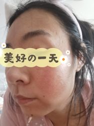 点击看大图 体验前-八大处整形