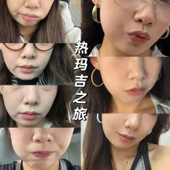 -上海伊莱美医疗美容医院