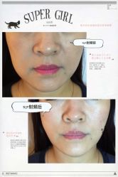 光SPA小V脸-光SPA科技美肤