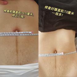-贝美佳产后修复中心