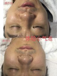 -痘院长·祛痘·皮肤管理