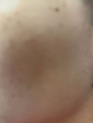 -美瑞莎创美医疗美容