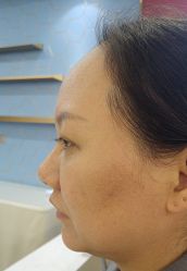 -长沙雅美医疗美容医院