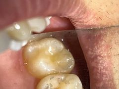 -同步齿科·数字化正畸种植口腔中心(前山店)