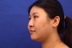 -洁铭新加坡医美