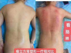-瘦立方身材管理中心