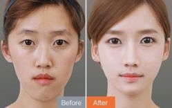 点击看大图 -SKINIST丽铂医疗美容