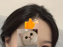 -大麦微针植发全国连锁