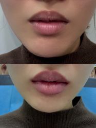 -上海漾颜医疗美容