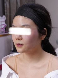 -Yestar重庆艺星医疗美容医院